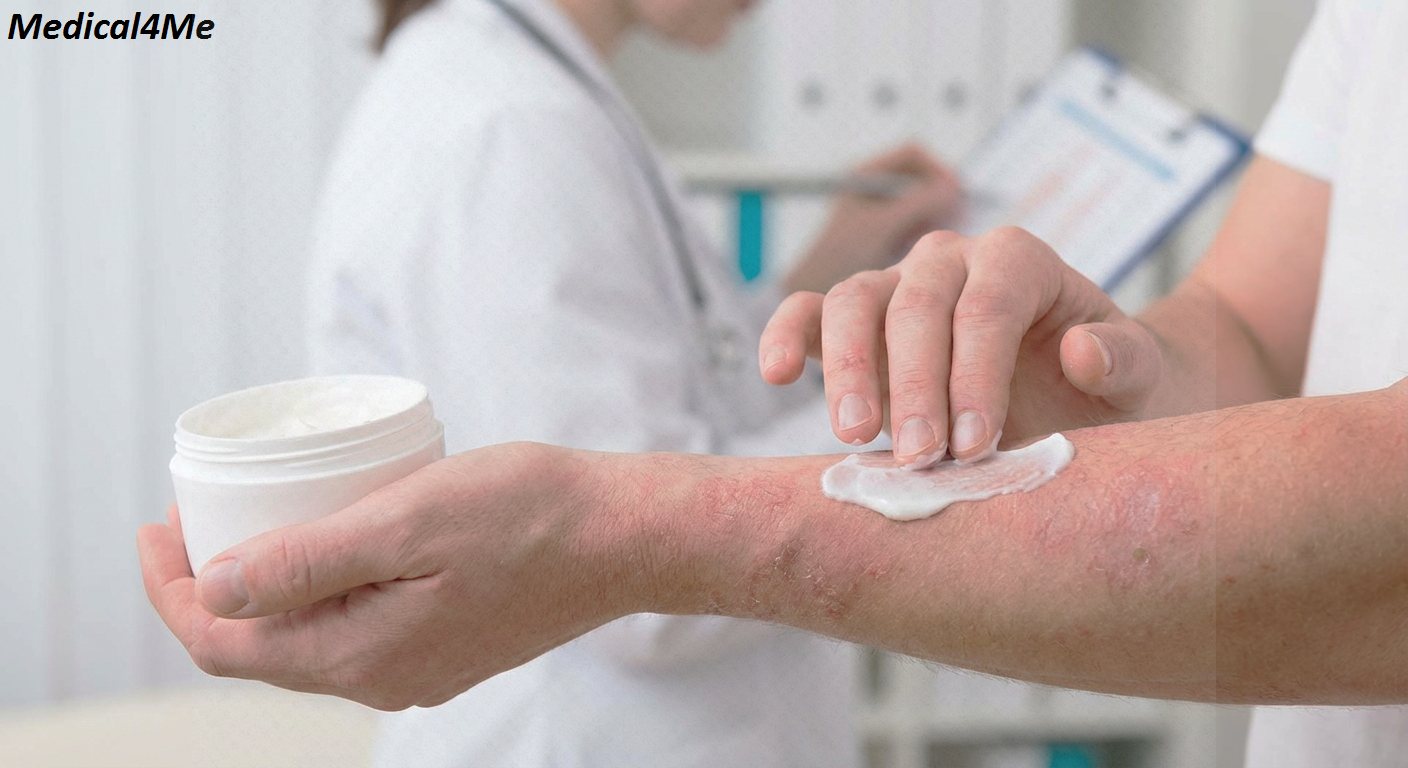 dermatitis treatment options comparison - medications vs lifestyle changes
